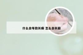 什么会导致长癣 怎么会长藓