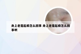 身上老是起癣怎么回事 身上老是起癣怎么回事啊