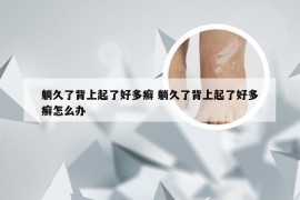 躺久了背上起了好多癣 躺久了背上起了好多癣怎么办