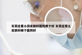 石家庄看小孩皮肤科医院那个好 石家庄婴儿皮肤科哪个医院好