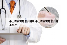 手上有白斑是怎么回事 手上有白斑是怎么回事照片