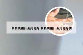 长白斑用什么药膏好 长白斑用什么药膏好使