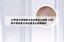 14岁孩子耳后有小白点是怎么回事 14岁孩子耳后有小白点是怎么回事图片