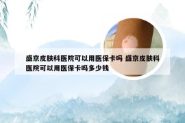 盛京皮肤科医院可以用医保卡吗 盛京皮肤科医院可以用医保卡吗多少钱