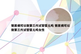 银屑病可以做第三代试管婴儿吗 银屑病可以做第三代试管婴儿吗女性