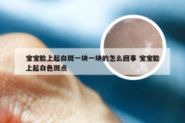 宝宝脸上起白斑一块一块的怎么回事 宝宝脸上起白色斑点