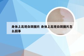 身体上出现白斑图片 身体上出现白斑图片怎么回事