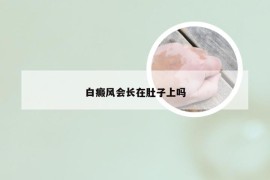 白癜风会长在肚子上吗