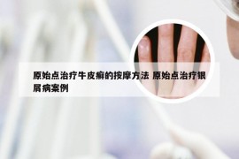 原始点治疗牛皮癣的按摩方法 原始点治疗银屑病案例