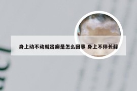 身上动不动就出癣是怎么回事 身上不停长藓