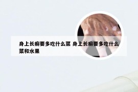 身上长癣要多吃什么菜 身上长癣要多吃什么菜和水果