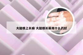 大腿根上长癣 大腿根长癣用什么药好