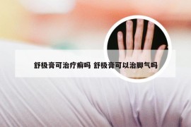 舒极膏可治疗癣吗 舒极膏可以治脚气吗