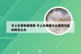 手上长像有癣很痒 手上长癣是什么原因引起的痒怎么办