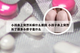 小孩身上突然长癣什么原因 小孩子身上突然长了很多小疹子是什么