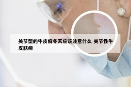 关节型的牛皮癣冬天应该注意什么 关节性牛皮肤癣