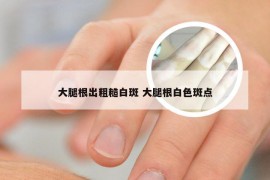 大腿根出粗糙白斑 大腿根白色斑点