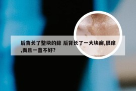 后背长了整块的藓 后背长了一大块癣,很痒,而且一直不好?