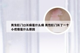 男生肛门口长癣是什么病 男性肛门长了一个小疙瘩是什么原因