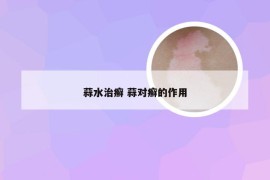 蒜水治癣 蒜对癣的作用