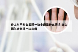 身上时不时会出现一块小癣是什么情况 身上偶尔会出现一块皮癣