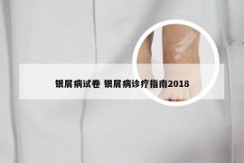 银屑病试卷 银屑病诊疗指南2018