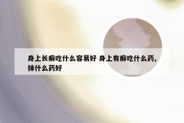 身上长癣吃什么容易好 身上有癣吃什么药,抹什么药好