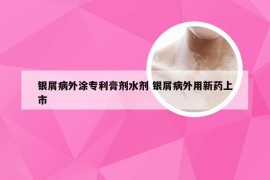 银屑病外涂专利膏剂水剂 银屑病外用新药上市