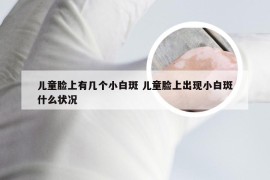 儿童脸上有几个小白斑 儿童脸上出现小白斑什么状况