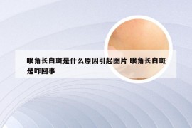 眼角长白斑是什么原因引起图片 眼角长白斑是咋回事