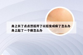 身上长了点点然后开了以后变成癣了怎么办 身上起了一个癣怎么办