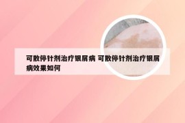 可散停针剂治疗银屑病 可散停针剂治疗银屑病效果如何