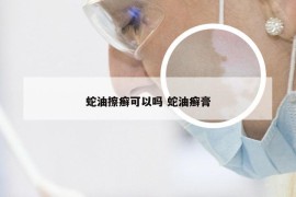 蛇油擦癣可以吗 蛇油癣膏