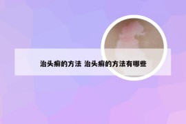 治头癣的方法 治头癣的方法有哪些