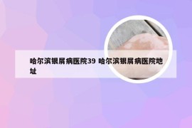 哈尔滨银屑病医院39 哈尔滨银屑病医院地址