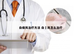 白癍风治疗方法 白瘨风怎么治疗