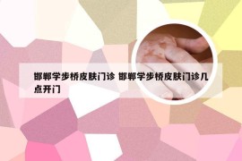 邯郸学步桥皮肤门诊 邯郸学步桥皮肤门诊几点开门