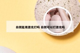 白斑能用激光打吗 白斑可以打激光吗