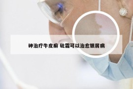 砷治疗牛皮癣 砒霜可以治愈银屑病