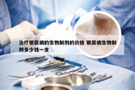 治疗银屑病的生物制剂的价格 银屑病生物制剂多少钱一支