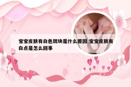 宝宝皮肤有白色斑块是什么原因 宝宝皮肤有白点是怎么回事