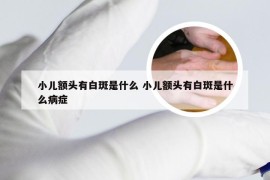 小儿额头有白斑是什么 小儿额头有白斑是什么病症