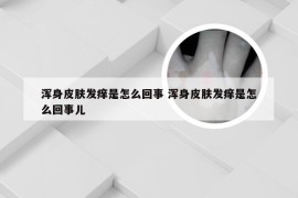 浑身皮肤发痒是怎么回事 浑身皮肤发痒是怎么回事儿