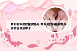 黄石哪家皮肤医院最好 黄石皮肤科医院最权威的医生是哪个