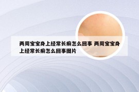 两周宝宝身上经常长癣怎么回事 两周宝宝身上经常长癣怎么回事图片