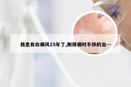 我患有白癞风15年了,刚得病时不停的治…