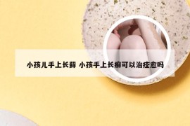 小孩儿手上长藓 小孩手上长癣可以治痊愈吗