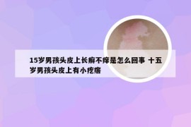 15岁男孩头皮上长癣不痒是怎么回事 十五岁男孩头皮上有小疙瘩