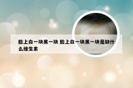 脸上白一块黑一块 脸上白一块黑一块是缺什么维生素