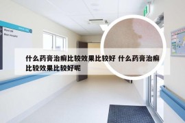 什么药膏治癣比较效果比较好 什么药膏治癣比较效果比较好呢